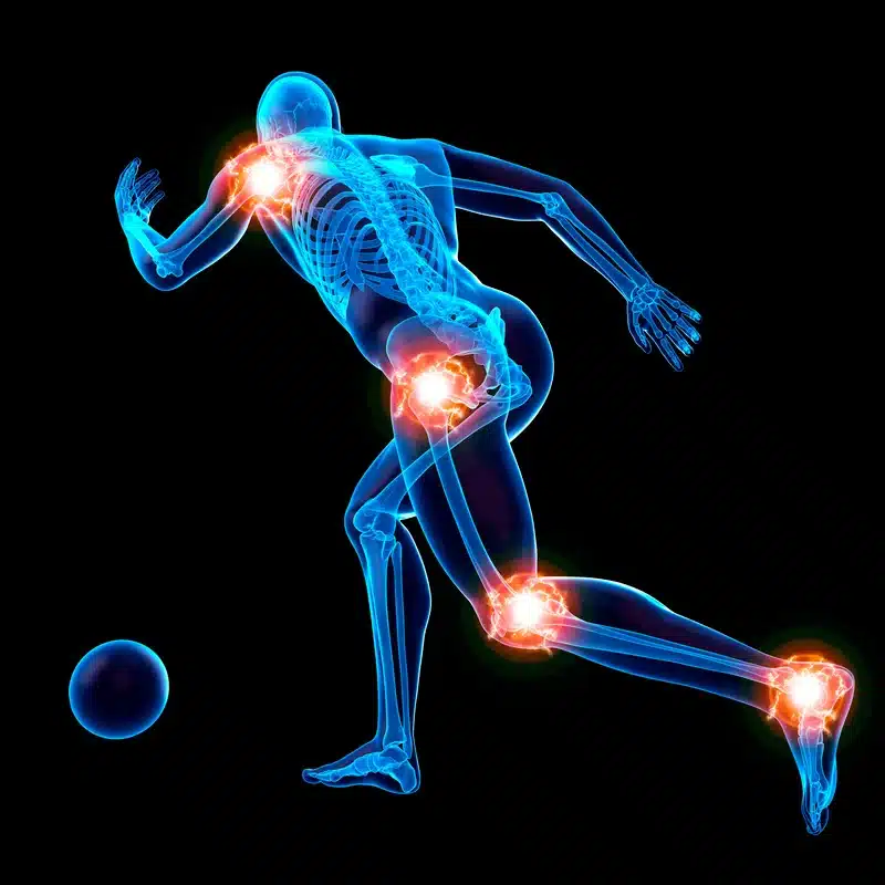 Sports Injuries